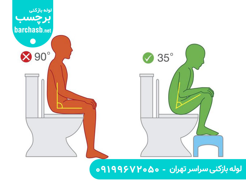 مزایای سنگ توالت طبی ایرانی نسبت به توالت فرنگی